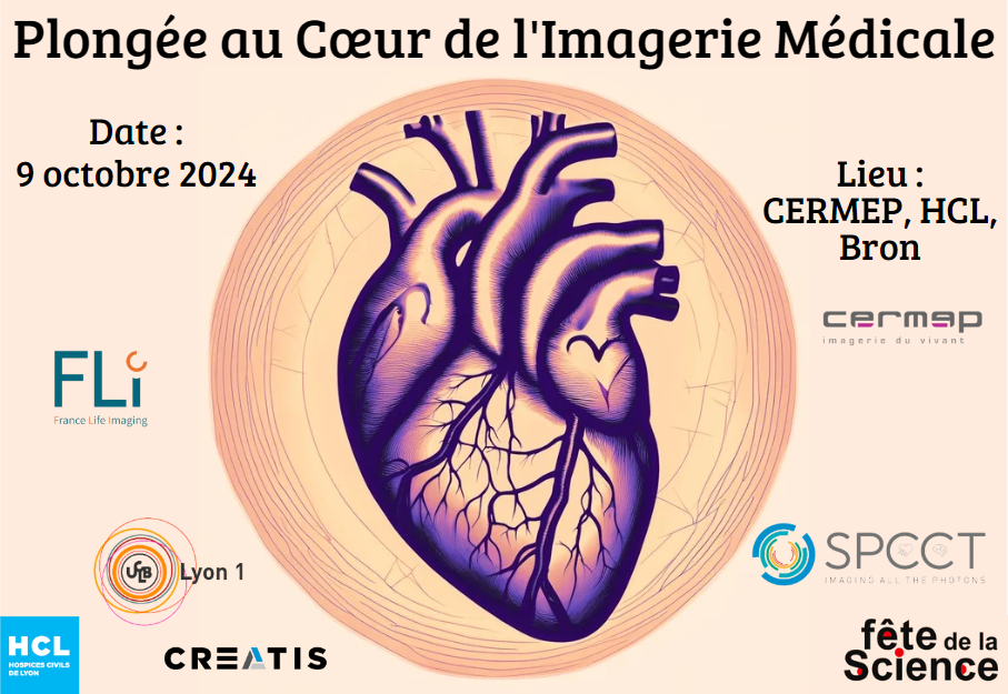 Dive into the Heart of Medical Imaging during the French Science Festival